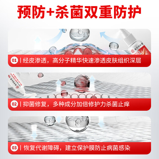 Lejia's old store Nanjing Tongrentang removes athlete's foot, foot odor, soothes itching, rotten foot skin, fungal infection, skin antibacterial