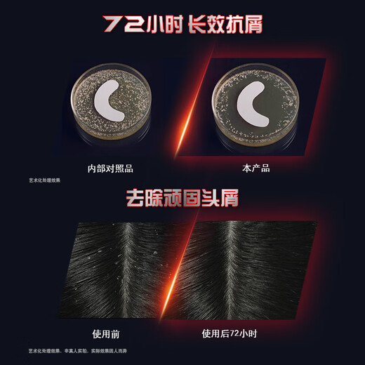 Qingyang Men's Energizing Bottle Shampoo Anti-dandruff and anti-itch 570g Anti-dandruff repair shampoo OCC popular products