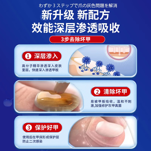 Higashida Japan’s No. 1 effective medicine for onychomycosis to cure genuine fungal infection and thickened onychomycosis imported antibacterial liquid 3 boxes suitable for mild onychomycosis buy 2 get 1 free