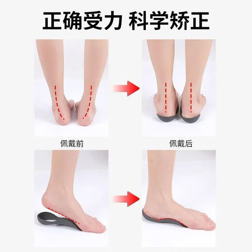 O-shaped leg flat foot correction foot valgus, calf valgus correction leg shape artifact straight leg foot half palm invisible tool L size 40-46 black 1 pair