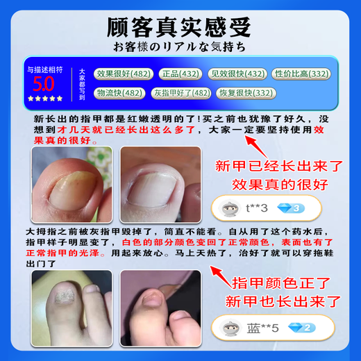Higashida Japan’s No. 1 effective medicine for onychomycosis to cure genuine fungal infection and thickened onychomycosis imported antibacterial liquid 3 boxes suitable for mild onychomycosis buy 2 get 1 free