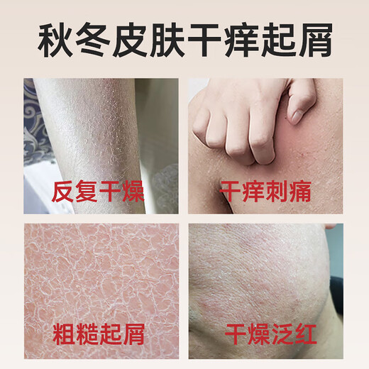 Miyamoto Musashi soothing and anti-itch body lotion moisturizing and moisturizing dry and flaky skin pro-vitamin B5 moisturizing lotion for men and women bottled trial pack