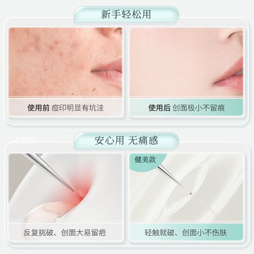 Jianmei Chuangyan Ultra-fine Acne Needle Set Cell Clip Blackhead Removal Tweezers Scraping Closed Mouth Squeezing Acne Removal Needle Cleaning Tool Ultra-sharp Cell Clip-Hook 1 piece