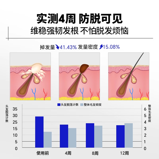 EHD防脱防断固发洗发水护发素洗护套装洗发水500ml+护发素400ml