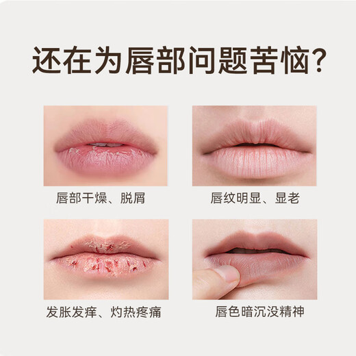 Jingzhou Sancao oil lip balm medical research moisturizing and diluting lip lines genuine men and women children chapped and peeling 8g