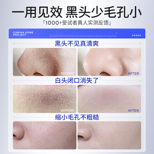 Huameike HURMEVKOR Mitesser-Reinigungsartefakt-Nasenpflaster entfernt Mitesser, repariert Poren, verkleinert Poren und Akne, reinigt die Mitesser-Exportflüssigkeit gründlich, reinigt Poren und entfernt Mitesser, Pflegeset*2