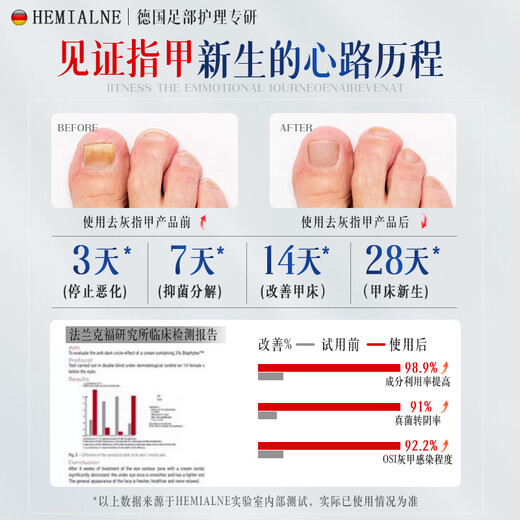 HEMIALNE German onychomycosis special effect medicine for thickening, yellowing, thickening and empty nails fungal infection onychomycosis 1 box of effective medicine 100% special effect for onychomycosis