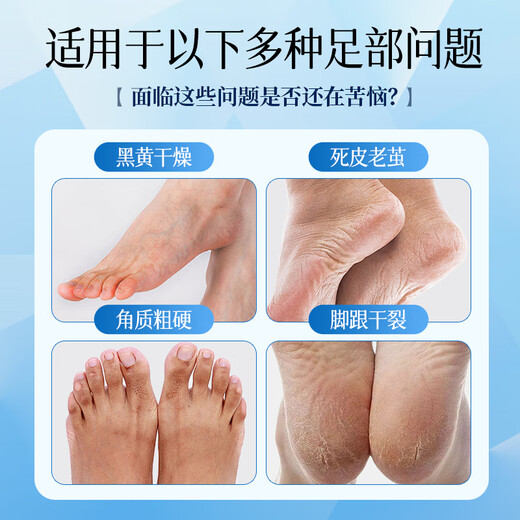 Zhenshy Vaseline Foot Mask Moisturizing and Lightening Foot Mask Exfoliating Dead Skin Tenderness Beautiful Feet Heels Chapped and Fine Lines Foot Care Moisturizing Repair Foot Mask *5 Pairs