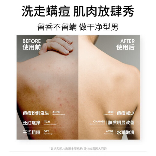 Zunlan men's shampoo and shower gel set, anti-dandruff, anti-itch, oil control, long-lasting fragrance shampoo and shower gel