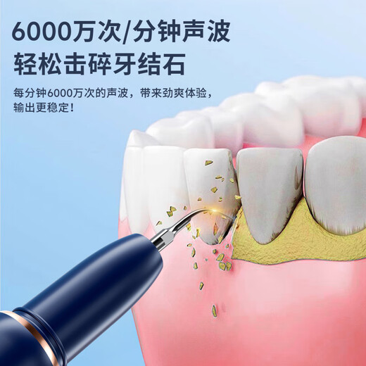 Sawang Germany Tooth Cleaner Household Calculus Remover Removes Smoke Stains and Yellowing Cleans Teeth Smoke Stains Tea Stains Tartar Calculus Scaler Dental Care Tool Starry Sky Blue 3000W High Frequency Teeth Cleaning Protects Teeth and Gums