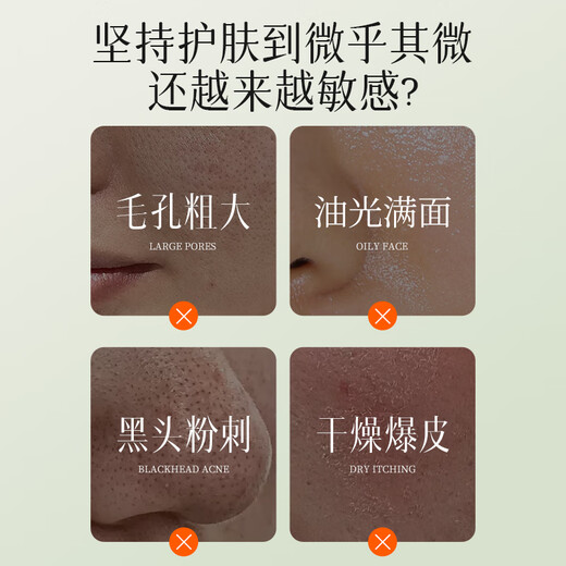 Tongrentang pore shrinking essence removes blackheads, repairs large pores, repairs fine pores for men and women