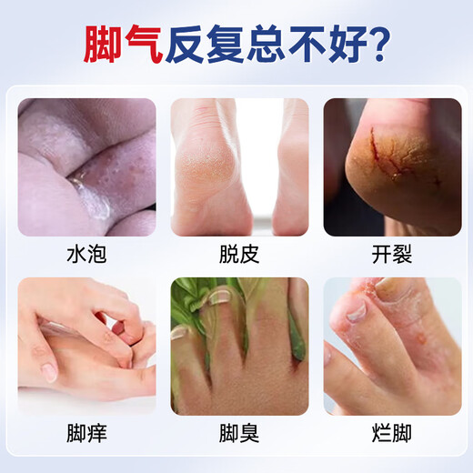 Renhe antibacterial herbal spray, athlete's foot, rotten toes, itchy feet, peeling blisters, fungal infection, antiseptic and anti-itch cream set