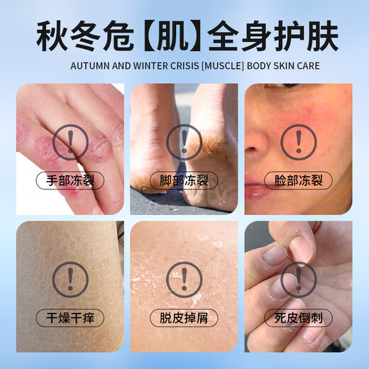 Shizhongtang Exploding Spirit Anti-freeze Cracked Vaseline Hand Cream to Prevent Chapped Hands and Feet, Non-Frostbites, Cracked Heels