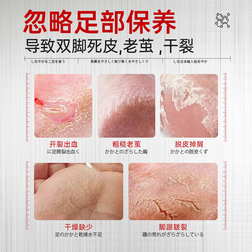 BEAUTY NOTES Japanese Horse Oil Foot Mask Foot Mask Cover Heels Cracked Exfoliation Dead Skin Calluses Foot Cover Rejuvenation Moisturizing