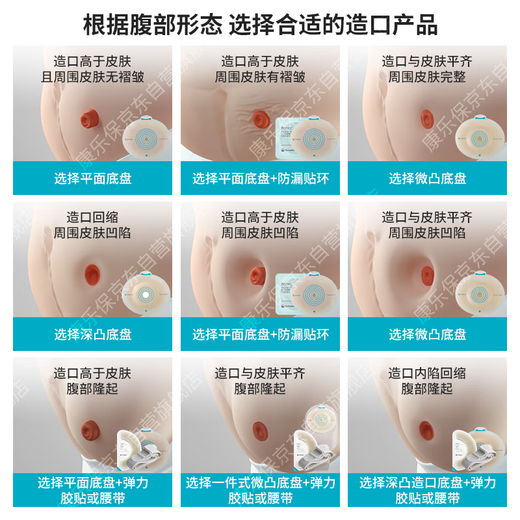 Kangle Baoshengshu Mio Ostomy Pocket de dos piezas de dos piezas de dos piezas ostomía convexa ostomía 16961*10+11452*30