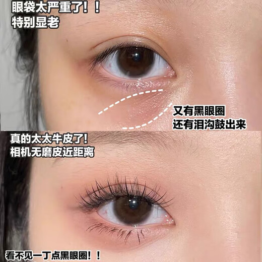 Shidanya ins three-color concealer multi-functional palette covers spots, acne marks, dark circles, conceals tear troughs without blocking lines