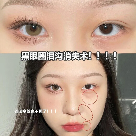 Shidanya ins three-color concealer multi-functional palette covers spots, acne marks, dark circles, conceals tear troughs without blocking lines