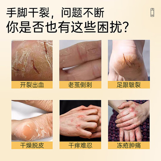 Hong Kong Pharmacy Horse Oil Cracked Cream Chilblain Cream Heel Moisturizing Anti-Dry Cracking Hand and Foot Cream Autumn and Winter Cracked Cream 1 Box Horse Oil Cracked Cream Effective Pack