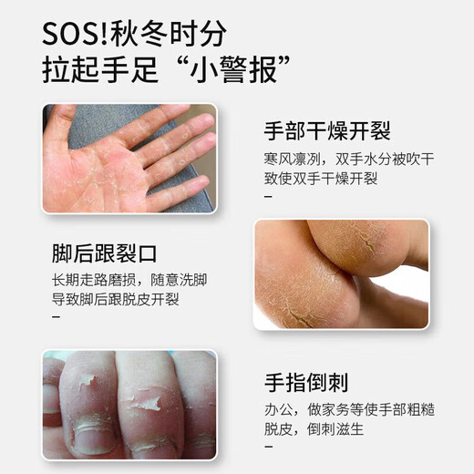 Hong Kong Pharmacy Horse Oil Cracked Cream Chilblain Cream Heel Moisturizing Anti-Dry Cracking Hand and Foot Cream Autumn and Winter Cracked Cream 1 Box Horse Oil Cracked Cream Effective Pack