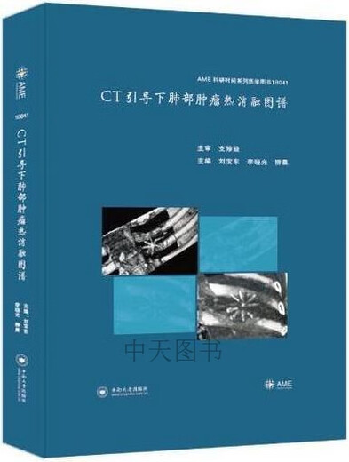 CT引导下肺部肿瘤热消融图谱 刘宝东, 李晓光, 柳晨主编 中南大学出版社