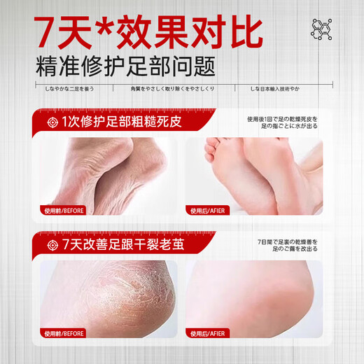BEAUTY NOTES Japanese Horse Oil Foot Mask Foot Mask Cover Heels Cracked Exfoliation Dead Skin Calluses Foot Cover Rejuvenation Moisturizing