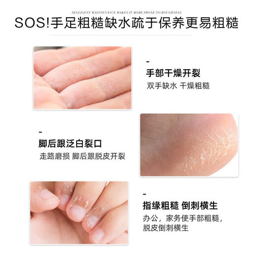 Miss Candy nail oil 7ml smoothes barbs, removes dead skin, moisturizes and softens nail surface, finger edge oil, avocado nutritional oil MC09