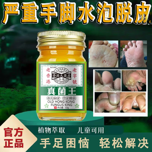 Hong Kong Big Pharmacy Fungus King can be used on hands and feet to relieve itching. Xiao Shuiying anti-itch cream for sore, itchy, peeling and cracking of toes. One bottle of 32g (trial size). Old Hong Kong, time-honored brand