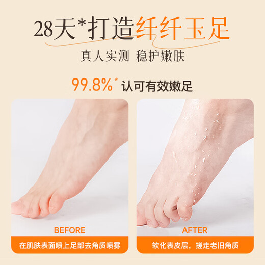 KOOGIS Lubricating Foot Peeling Spray 120ml Foot Mask to remove dead skin, rejuvenate your feet, improve dry and cracked heels