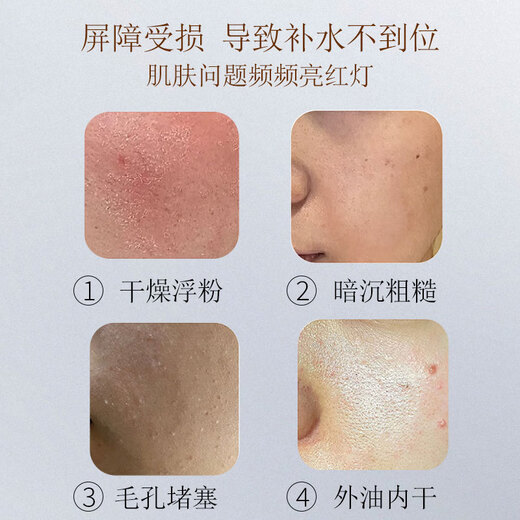 Sakose Vaseline Malaysian Glycerin Niacinamide Vitamin E Skin Care Lotion 120ml Body Oil Moisturizing and Brightening Skin