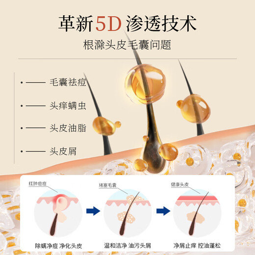 SACELLEC BEAUTE anti-degeneration ginger shampoo 400ml solid hair nourishing anti-dandruff anti-itch oil control fluffy shampoo for men and women