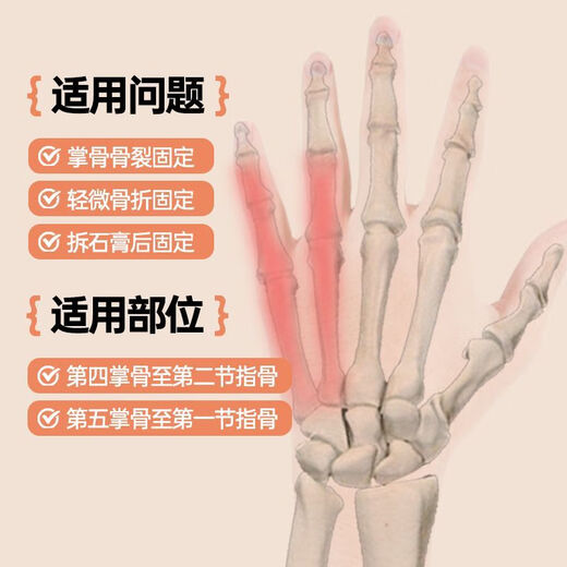 通用手掌骨折固定护具【1283人收藏】伊登第五掌骨器手指指套小拇指支 第五掌骨固定器 左手