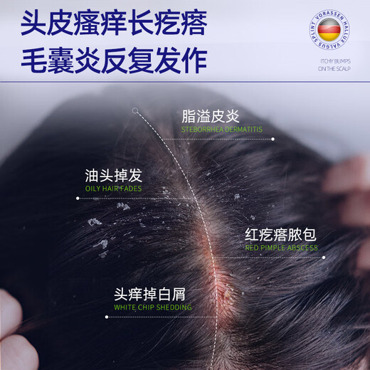 Warrenson Medical Anti-itching, Anti-Dandruff, Folliculitis Shampoo, Scalp Seborrheic Dermatitis Special Fungus Control Drug Administration Certification