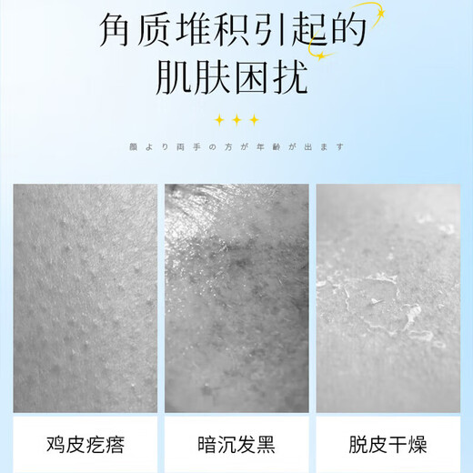 Vitamin E Urea Cream 20% Medical Nanjing Dermatology Institute Vitamin E Urea Cream Cream Ointment Improves Chicken Skin Cutin 1 bottle Improves Roughness 20% Urea Cream 150g