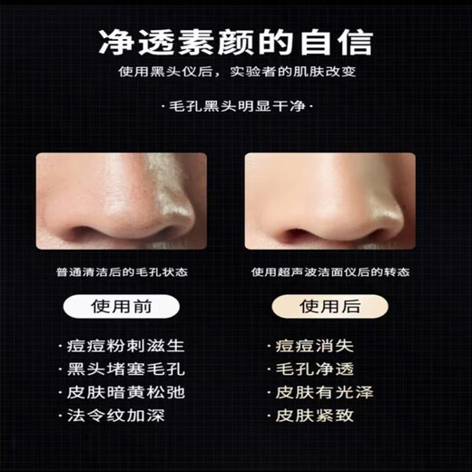 Facial multi-functional beauty instrument v-face firming, lifting and tightening 3D face-slimming instrument shaping v-face artifact ultrasonic atomization model electric blackhead shovel beauty instrument