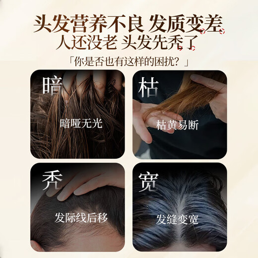 Bawang Shampoo Heshou Polygonum Multiflorum Shampoo previene la pérdida de cabello, negro, brillante, controlado por el aceite y limpiador de cabello esponjoso para hombres y mujeres Polygonum Multiflorum Cabello sólido 600G + Cabello y prevención de la pérdida de cabello 80G