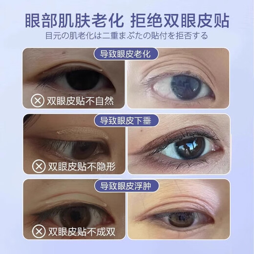 Taozhiyaoyao double eyelid shaping cream invisible traceless artifact waterproof and sweatproof non-permanent non-glue natural shaping droop patch