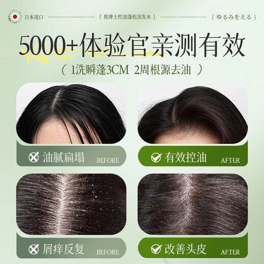 Dr. Jiao Japan Fett Donglai Shampoo Ölkontrolle Flauschige Frauen-Duft-Entfernung Schuppen Anti-Ownino-Aminosäure Shampoo Tau Flüssigkeit