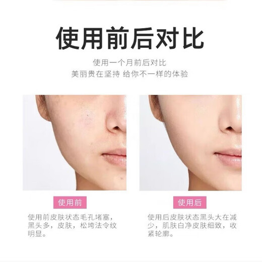 Facial multi-functional beauty instrument v-face firming, lifting and tightening 3D face-slimming instrument shaping v-face artifact ultrasonic atomization model electric blackhead shovel beauty instrument