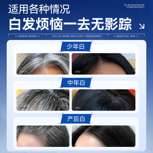 
Moihanr Fat Donglai Germany imported Polygonum multiflorum shampoo white hair reinforcing black hair root hair nourishing natural black shampoo [oil control and anti-dandruff plant rejuvenation] 1 bottle