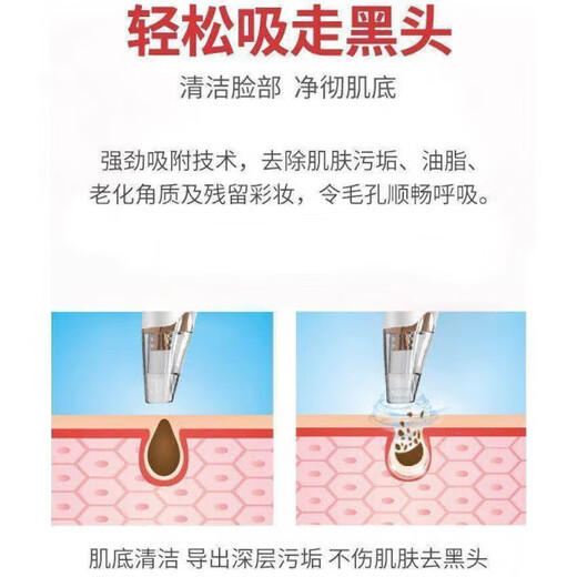 Sawang Germany Powerful blackhead suction instrument, super suction cleaner, automatic blackhead suction, acne pore shrinkage, household small bubble beauty instrument, acne removal artifact, hot sale - luxury configuration - three modes, three suction and three levels, 3 levels of suction, safe and not harmful to the skin