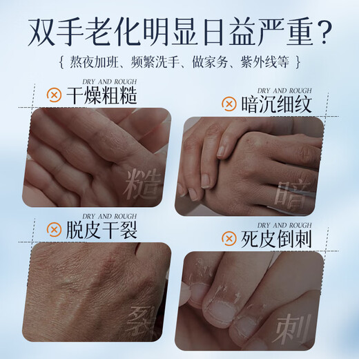 Dyey Vaseline Hand Cream for Cracked Hands and Feet Moisturizing Cream for Heel Cracks, Anti-Cracks, Cracks, Cracks and Cracks Cream, Anti-peeling Cream