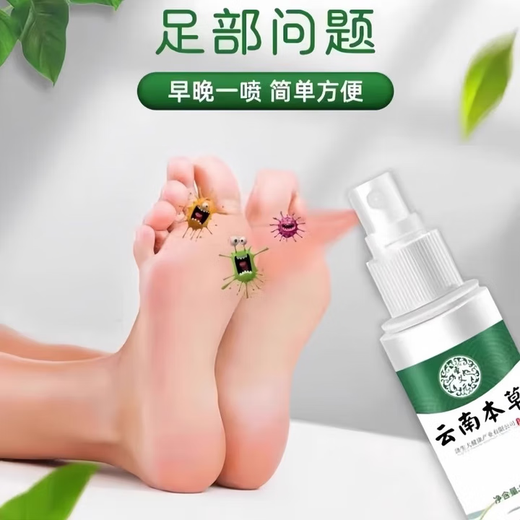 Yunnan herbal foot antibacterial spray for sweaty feet, smelly feet, athlete's foot, anti-itching, peeling, fungal infection, dry cracks on the back of the feet, 1 bottle 60ml trial pack