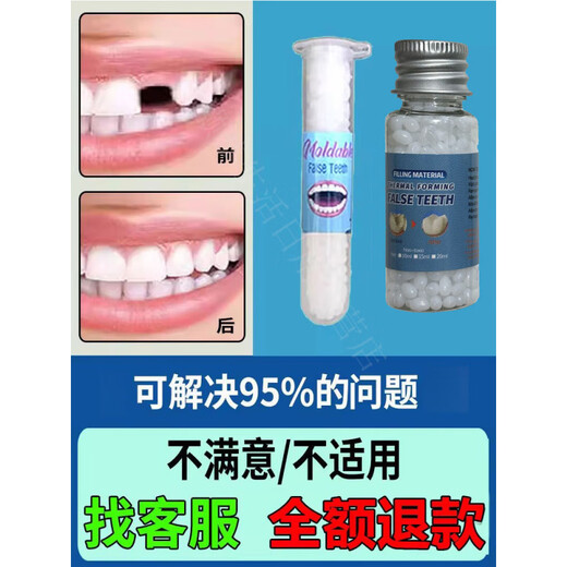Modou Shenghuo Artefakt-Zahnfüllung zu Hause, Hohlraumpaste, Lückenmaterial, Zahnspangen füllt die Lücken von falschen Zähnen 15 Mal (wird mit Anleitung + Werkzeugset geliefert)