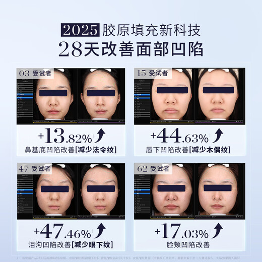 GEMO Double Collagen 4R Collagen Machine Beauty Instrument, the same style as the hospital line, home anti-aging light overclocking, lightening the nasolabial folds on the face, birthday gift for my wife and mother EG50