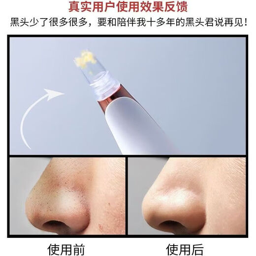 Xiaomi tip blackhead remover, pore remover, acne cleaner, small bubble cleansing instrument, facial and nose pore beauty instrument, men's blackhead extractor, a birthday and National Day gift for girlfriend, flagship rechargeable model, dual-button blackhead instrument + 6 types of suction heads