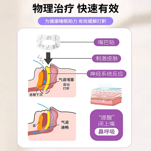 JCZS德国品牌口呼吸矫正贴嘴巴闭嘴神器睡觉嘴凸防张嘴闭合防打鼾儿童 【30枚-M码适用12-成人】防张口呼吸