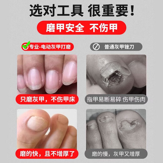 Mattai Tong onychomycosis grinder electric nail grinder manicure nail remover thick nail trimmer automatic nail removal tool