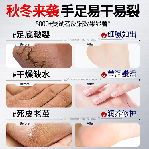 DR JEVEITAL Dr. JEVEITAL Cracked Feet Cream 150g Heel Anti-Dry Crack Heel Crack Crack Freeze Cream Repair Hand and Foot Moisturizer