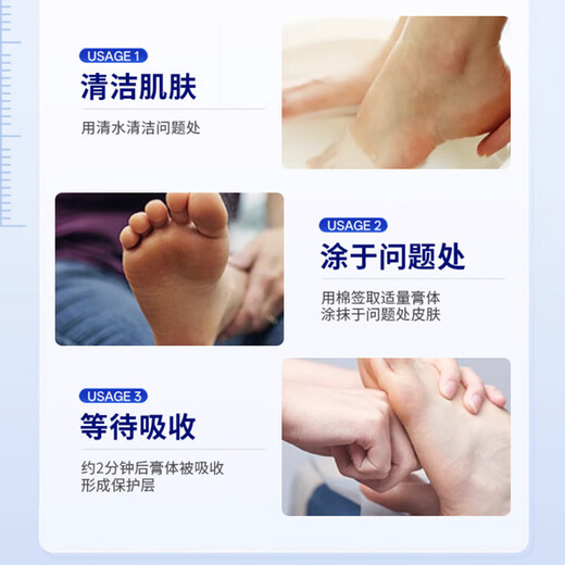 VKR Powerful Fungus King Athlete's Foot Cream Fungus Infected Feet Peeling, Erosion, Blisters, Sore Feet, Sweaty Feet, Odorful Feet Itching. Buy 2 shots and 3 boxes to eradicate the roots. Only spend 2 boxes.