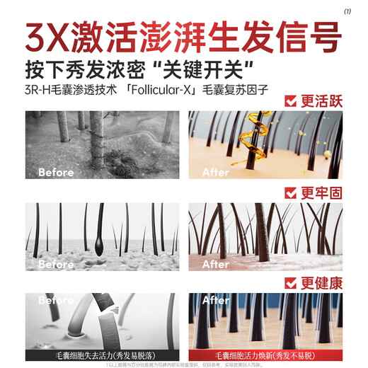 ZHENMI新加坡进口洗发水防脱育发生姜固发去屑防掉断发控油金榜第1名